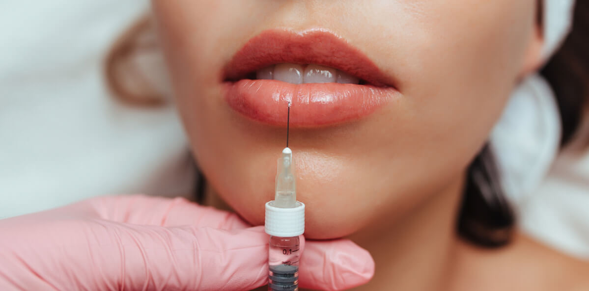 dermal fillers for lips